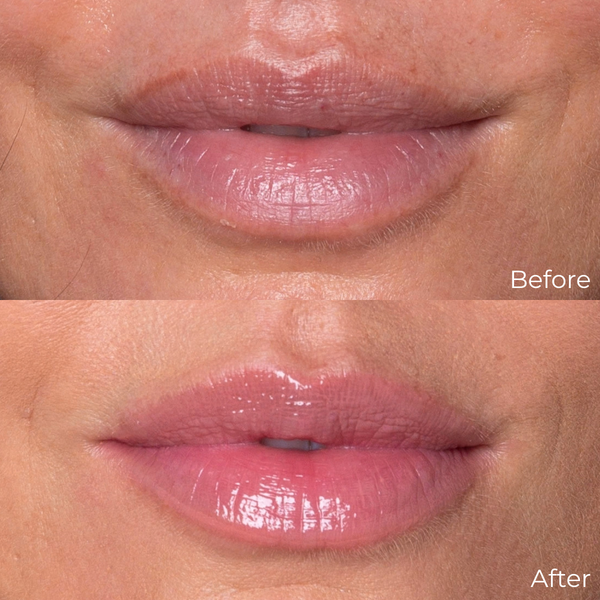 Supermodel Lip Bundles / Christy