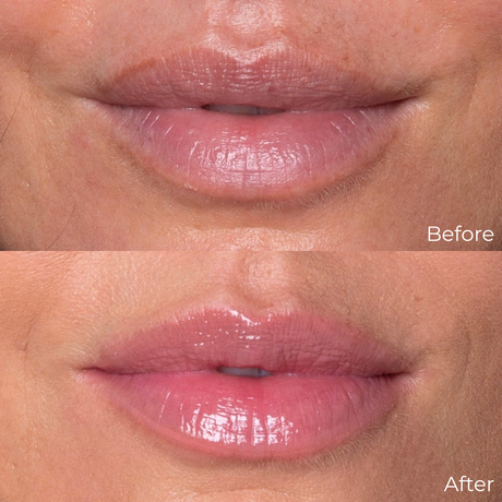 Peptide Lip Oil Trio