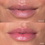 Supermodel Lip Bundles / Christy